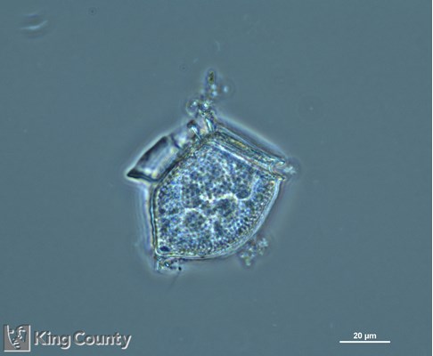 Photo of Dinophysis acuta/Dinophysis norvegica